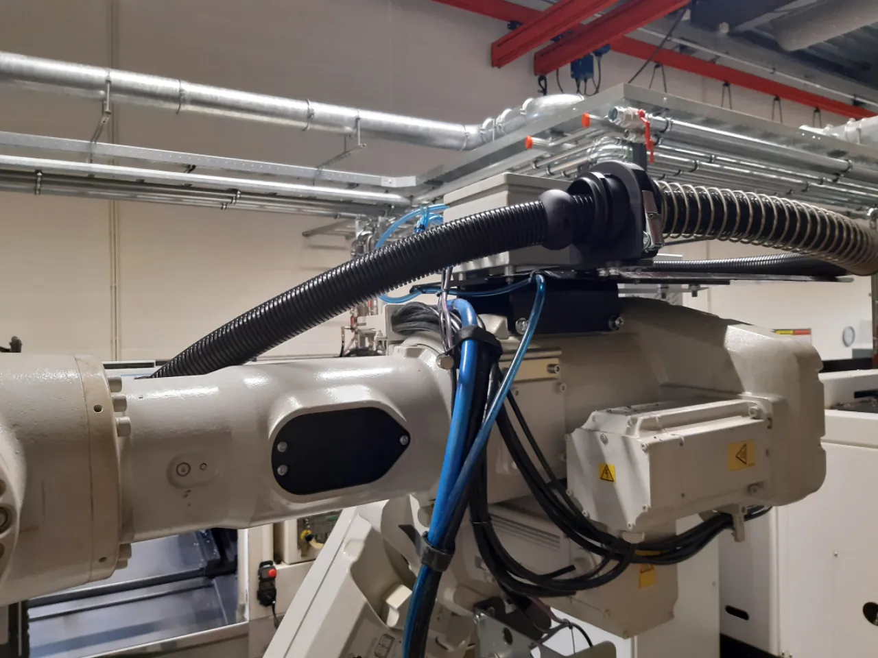 The retraction system along the upper arm
